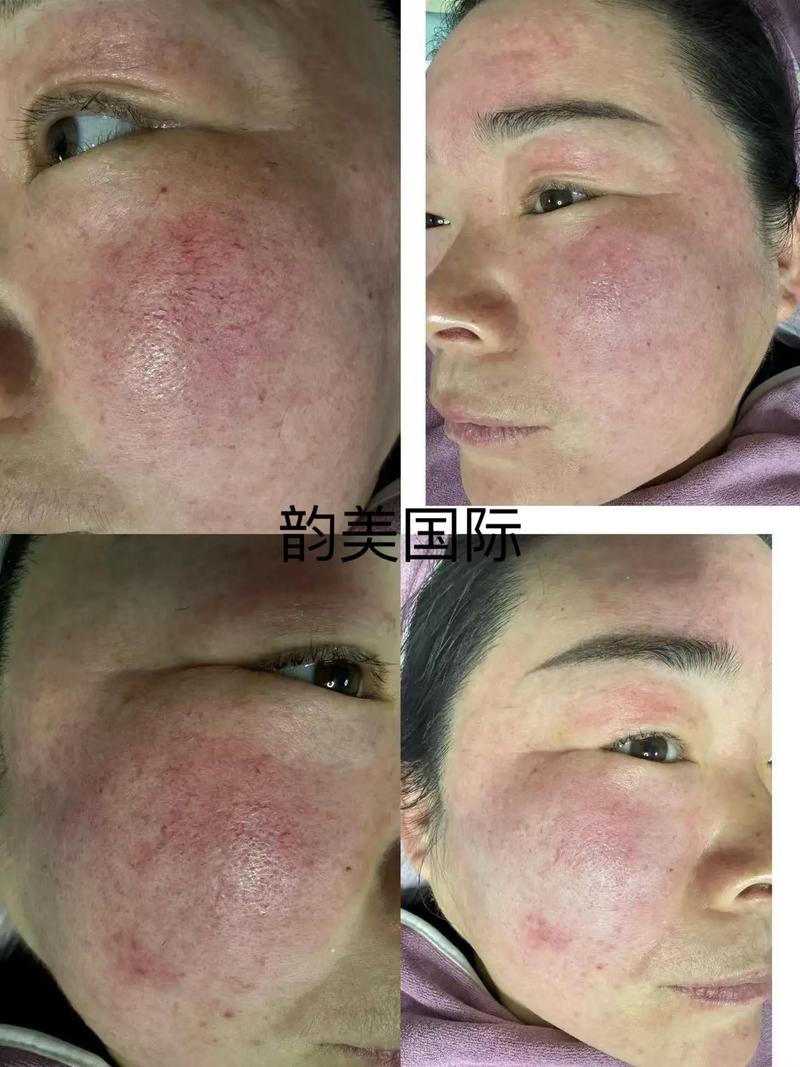 PS怎么添加脸部血丝效果？-图3
